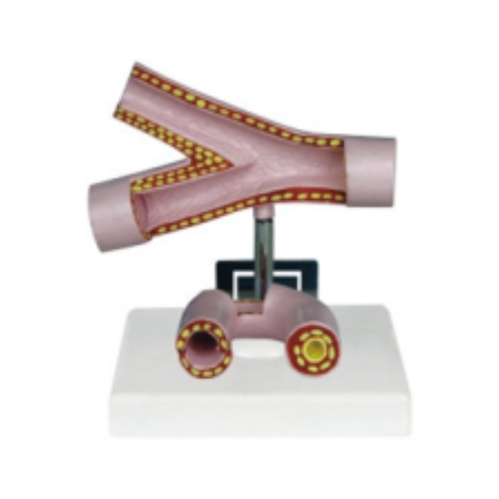 Modelo de arterias QH 3318-5