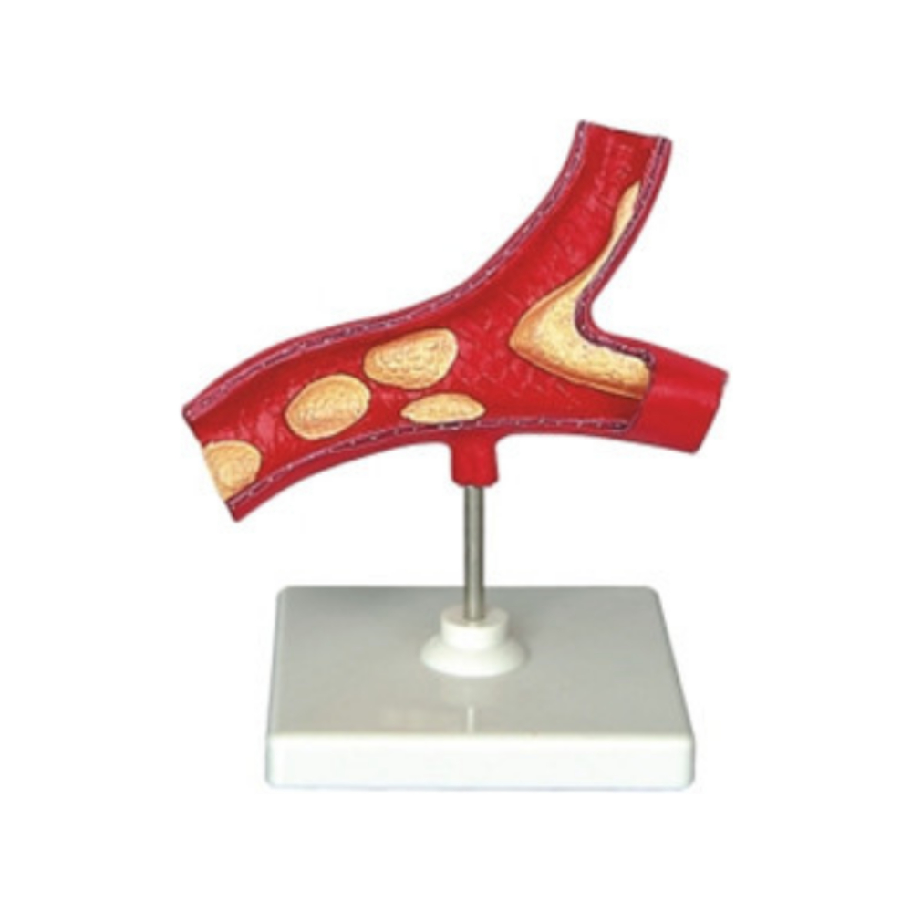 Modelo arterial QH 3318-2