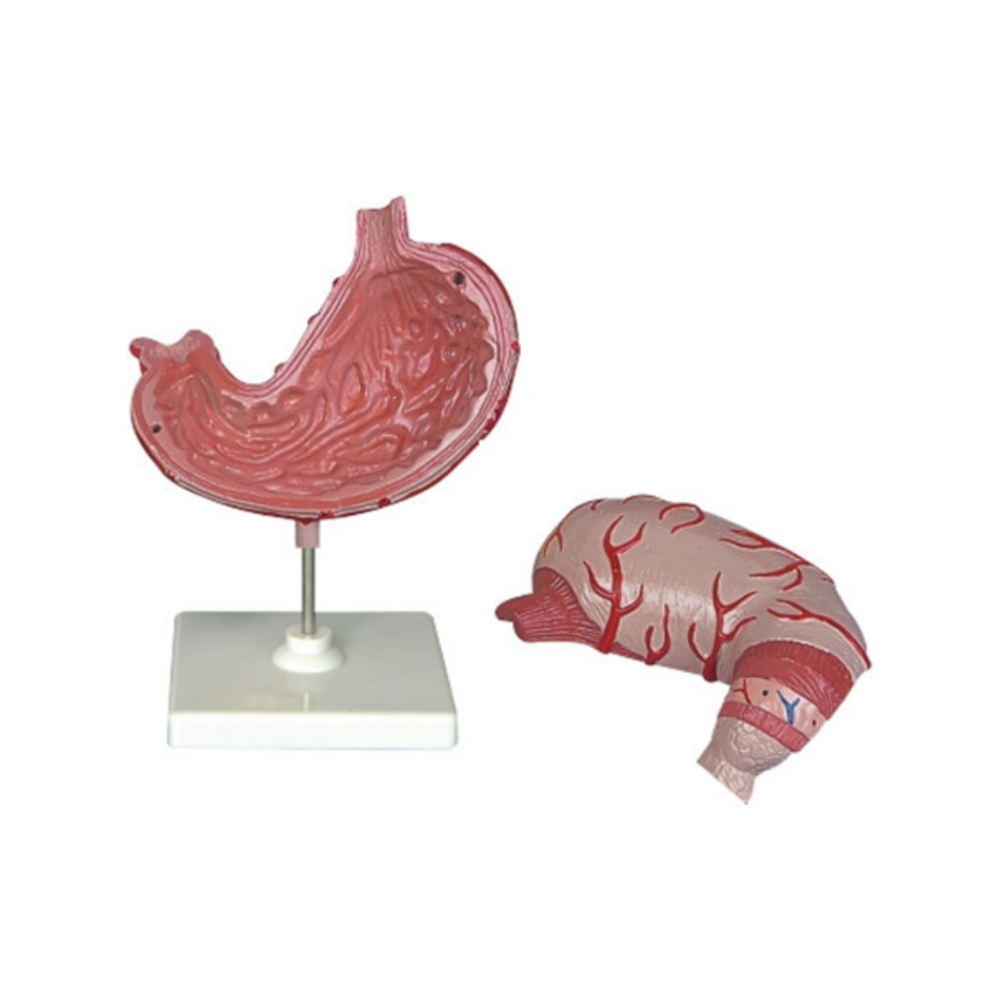 Modelo de estómago humano QH 3329-1