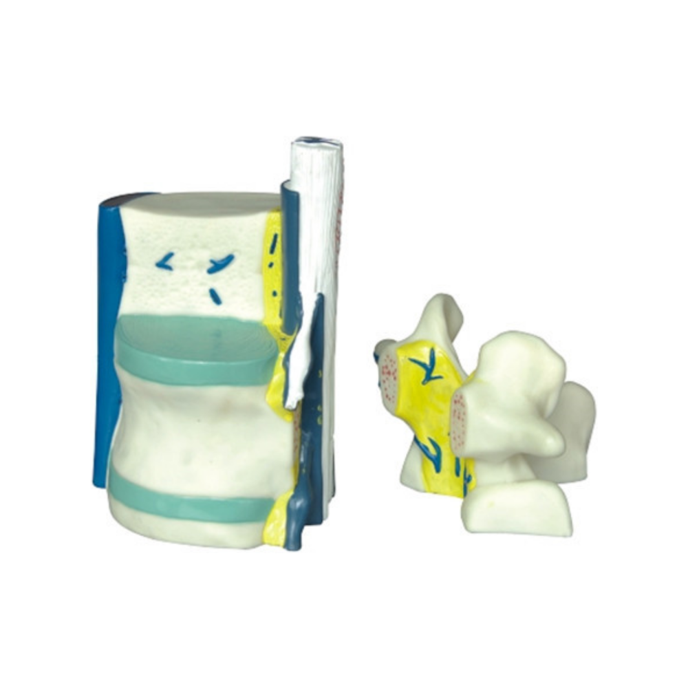 Médula espinal parcial QH 3308