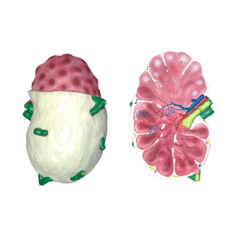 Ganglio linfático humano QH 3318