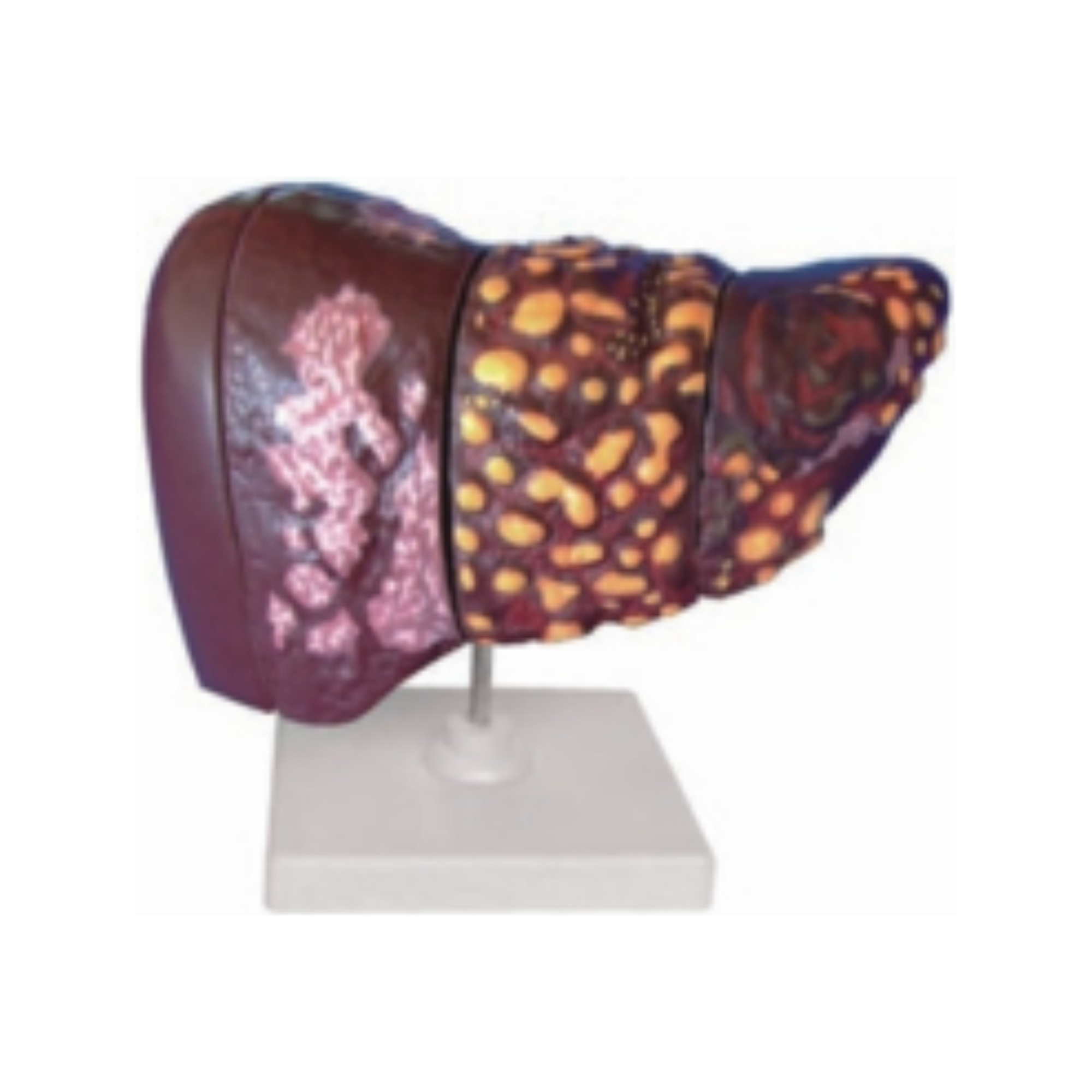 Modelo de enfermedad hepática QH 3316-3