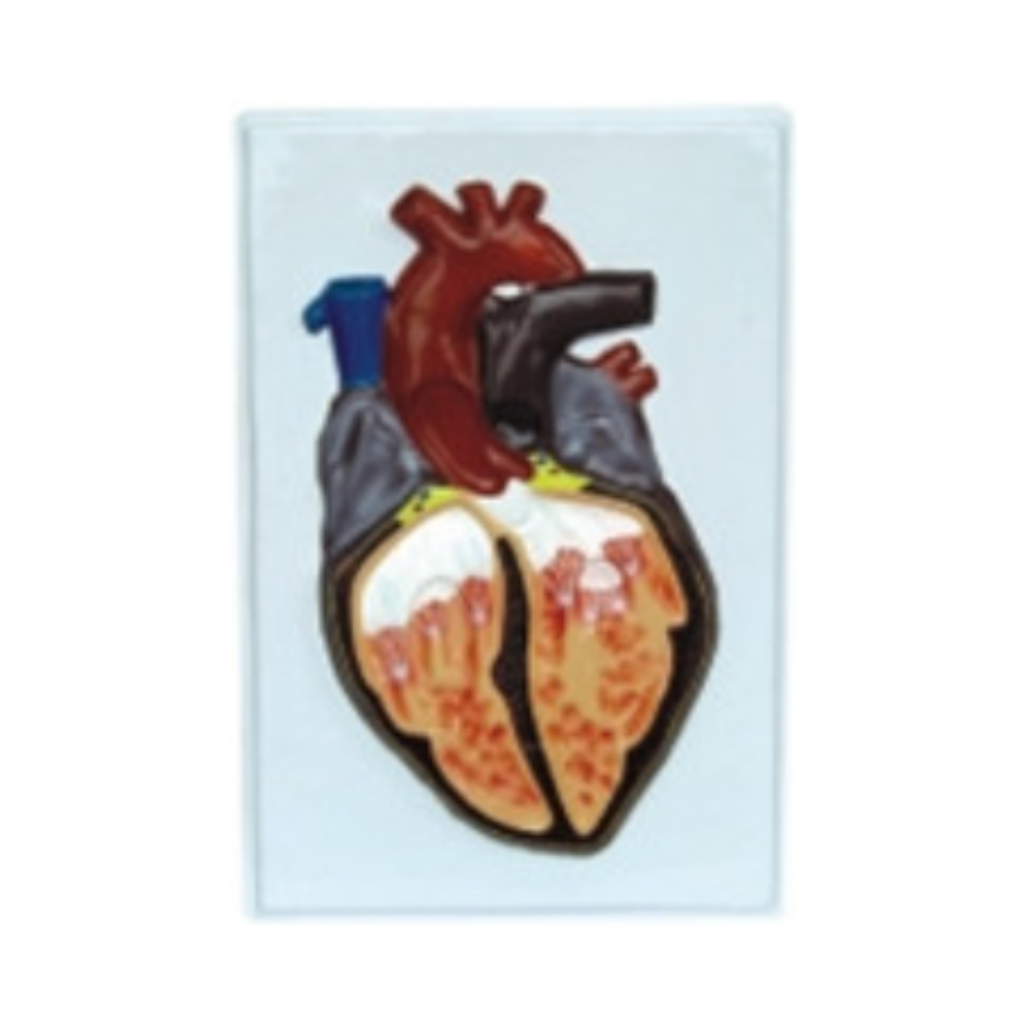 Modelo en relieve del corazón humano QH 1576