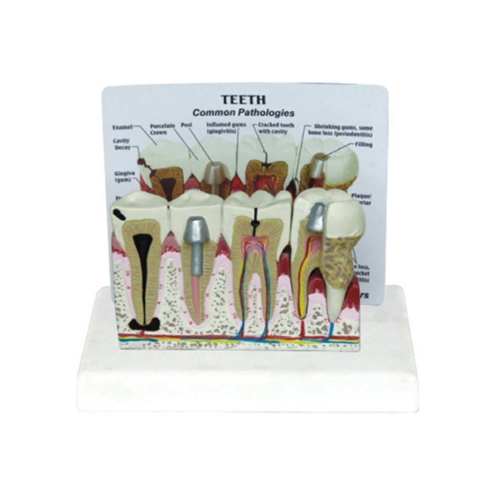 Modelo dental con placa descriptiva QH 3353-4