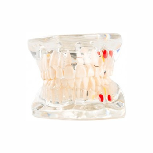 Modelo de dentadura #1