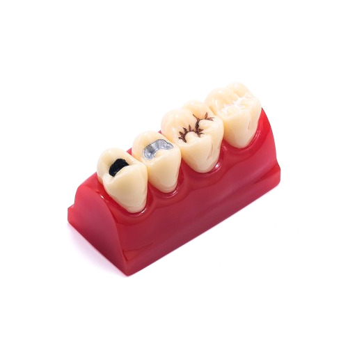 Modelo de dentadura #2