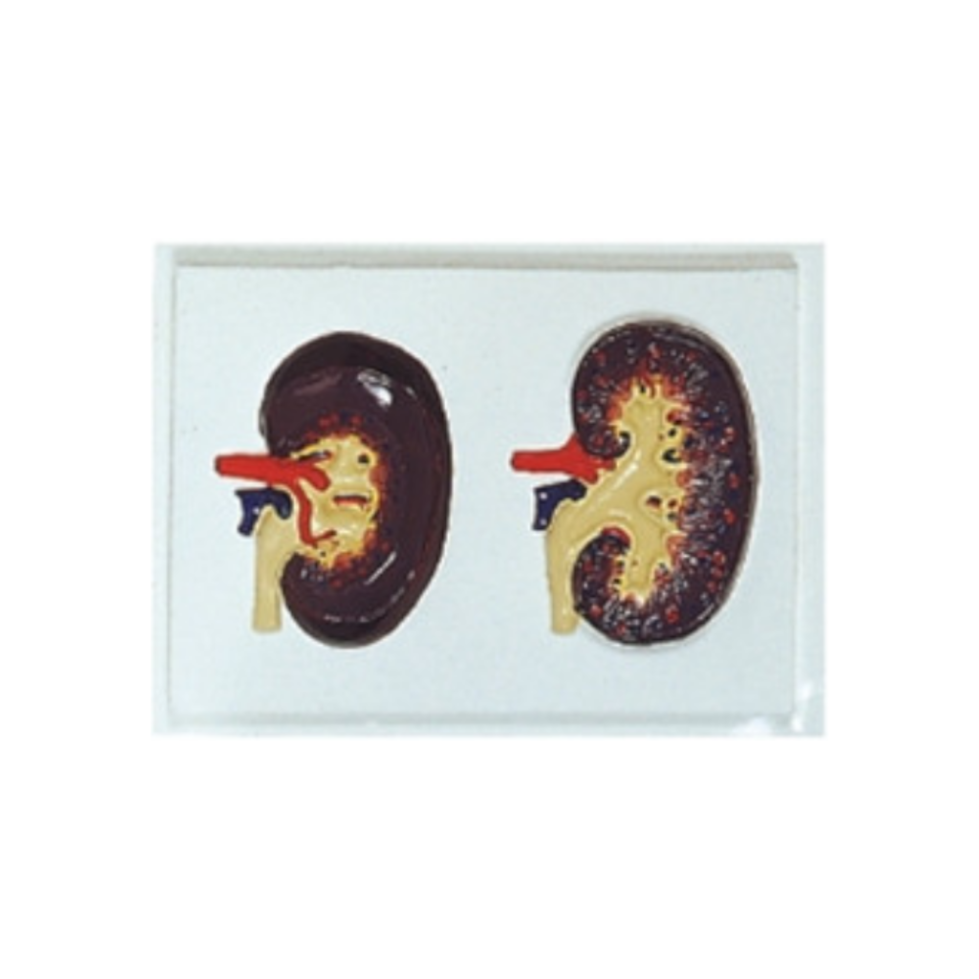 Modelo en relieve de la anatomía del riñón QH 1563